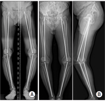 Radiographic Imaging