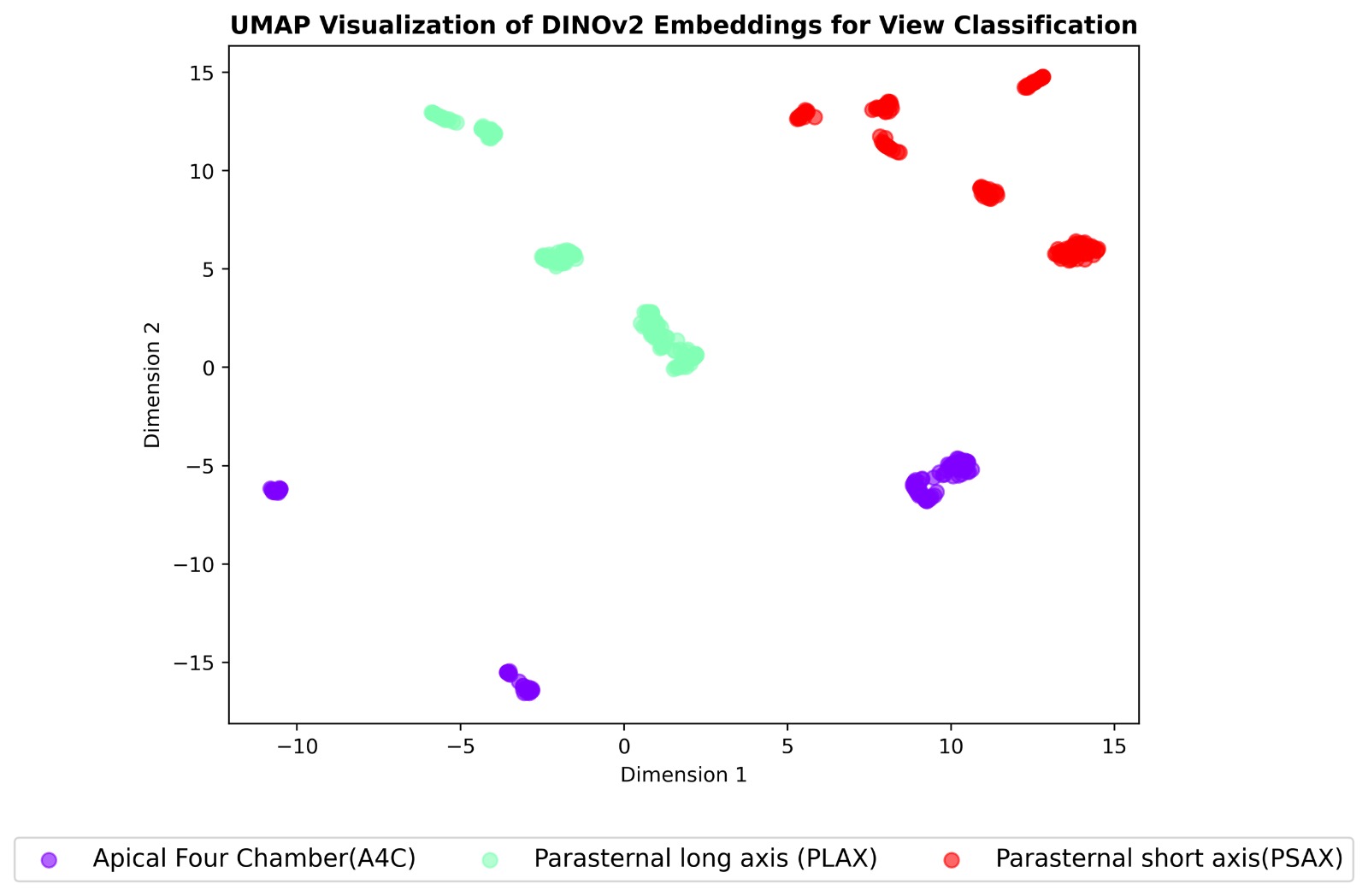 Dataset Augmentation